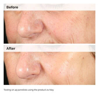 Corrective Dark Spot Solution